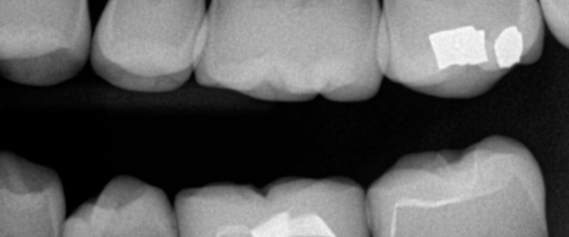 How often should dental xrays be taken?