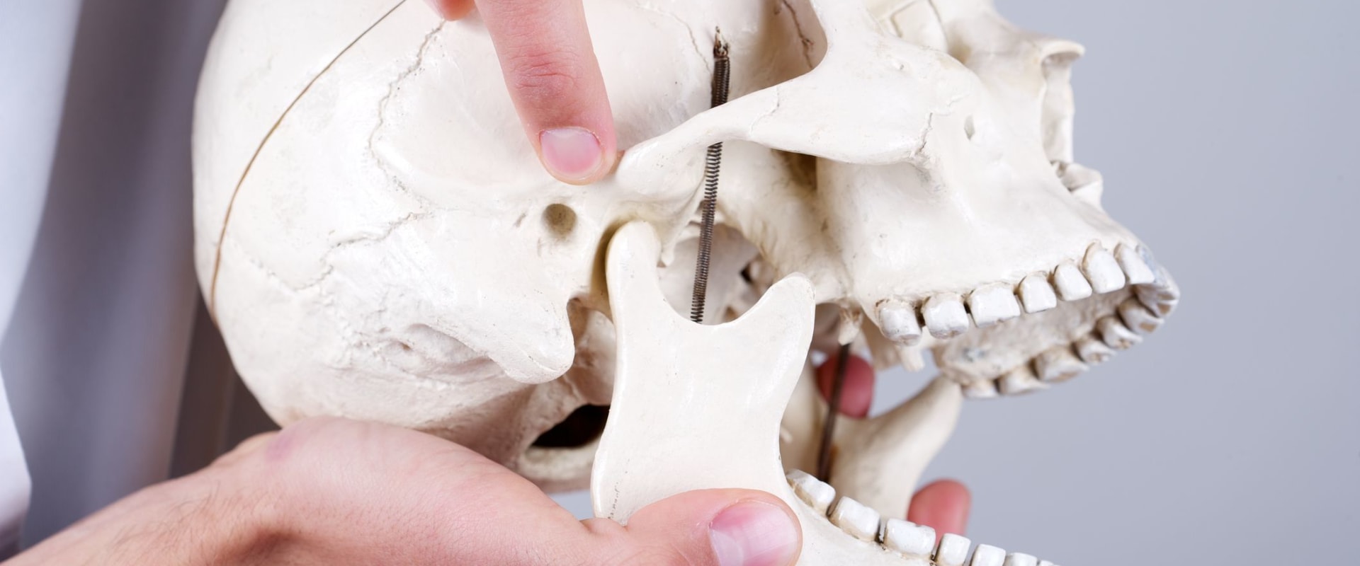 What is a full mouth xray called?