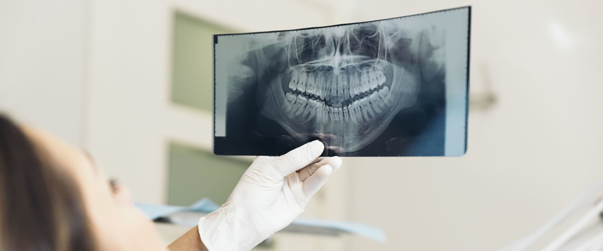 How To Determine If You Need A Dental Xray Before Visiting A Dentist