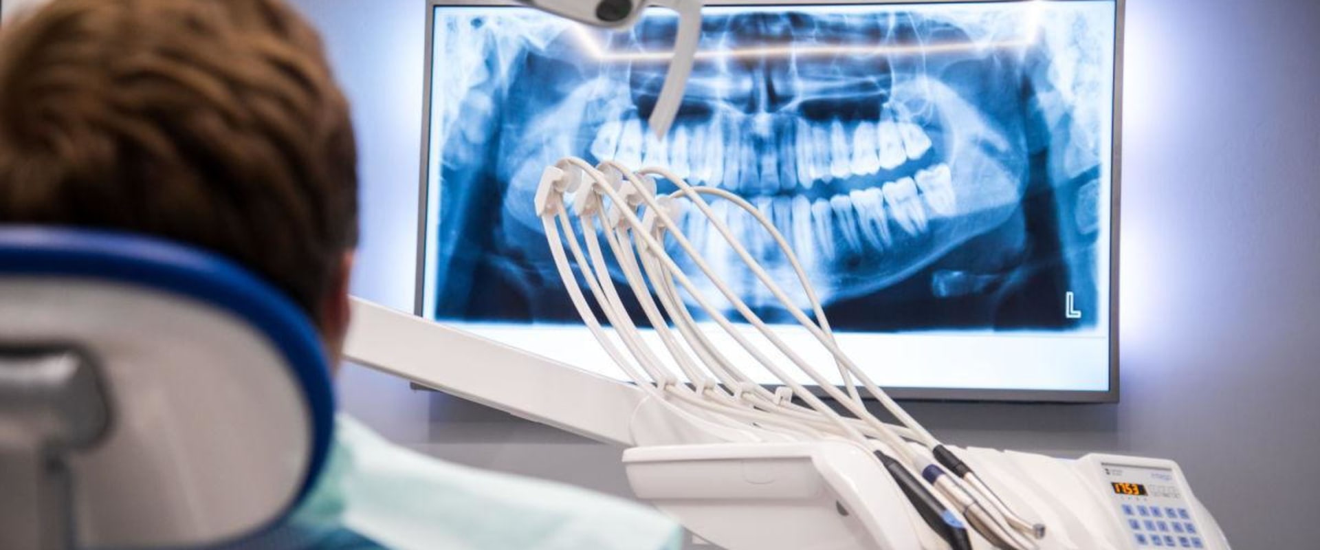 Do dental xrays give off radiation?