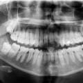 What is dental x ray?