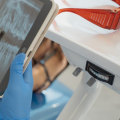 Getting The Best Results: The Role Of Dental X-Rays In Cosmetic Dentistry In Austin