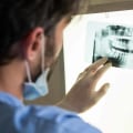 Are dental x-rays really necessary?