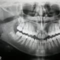When are dental x rays necessary?