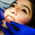 Achieve A Picture-Perfect Smile With Porcelain Veneers In Conroe, TX: Unveiling The Magic Of Dental X-rays