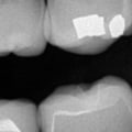 How often should dental x-rays be taken?