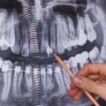 What are the different types of dental x-rays?