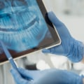 How Dental X-Rays Help Dentists Assess Denture Fit And Function In South Riding, VA