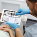 Unveiling The Hidden: Why Dental X-Rays Are Vital For Successful Dental Implants In Taylor, Texas