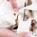 What is a full mouth x-ray called?
