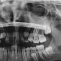 Where are dental x-rays developed?