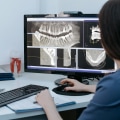 Seeing Beyond The Surface: The Crucial Role Of Dental X-Rays In Helotes, TX