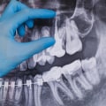 X-Ray Imaging In Dripping Springs, TX: How Dentists Use It to Diagnose And Treat Oral Health Issues