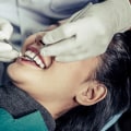 The Role Of Dental X-Rays In Planning And Placing Dental Crowns In Gainesville, VA