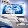 Do dental x-rays give off radiation?