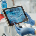 Why Dental X-rays Are Essential For Your Oral Health: Insights From A Spring Branch Dentist