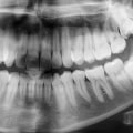 Enhancing Your Oral Health: The Importance Of Dental X-Rays From Ellsworth Dentists