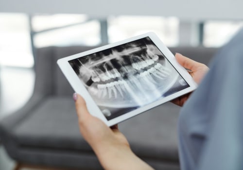 Your Veneers Start With Precision: Why Dental X-Rays Matter In Honolulu
