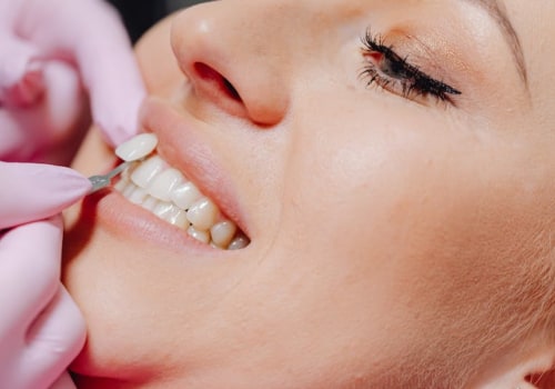 Unlocking Your Dream Smile: How Dental X-Rays Pave The Way For Veneers In Cedar Park, Texas
