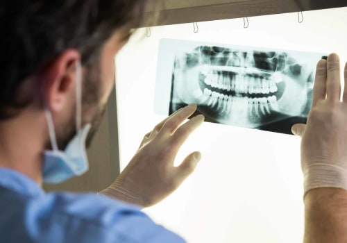 Are dental x-rays really necessary?