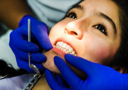 Achieve A Picture-Perfect Smile With Porcelain Veneers In Conroe, TX: Unveiling The Magic Of Dental X-rays