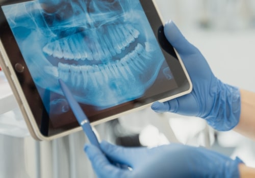 Understanding Dental X-Rays: An Essential Guide For Patients In Round Rock, Texas