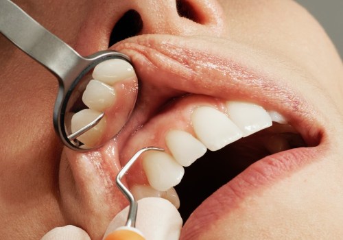 Understanding The Importance Of Dental X-rays During A Visit To A Dentist In Boerne, TX