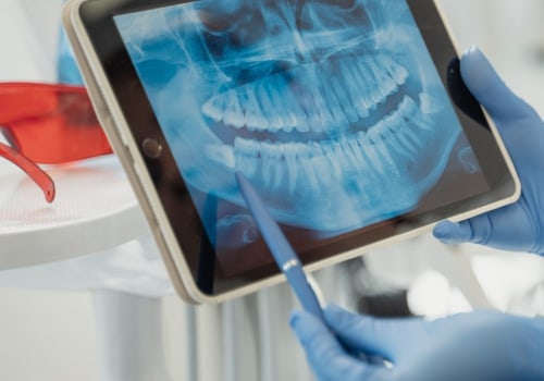 How Dental X-Rays Help Dentists Assess Denture Fit And Function In South Riding, VA