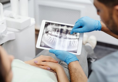 Unveiling The Hidden: Why Dental X-Rays Are Vital For Successful Dental Implants In Taylor, Texas