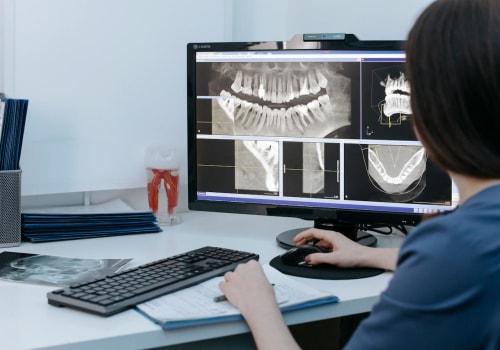 Seeing Beyond The Surface: The Crucial Role Of Dental X-Rays In Helotes, TX