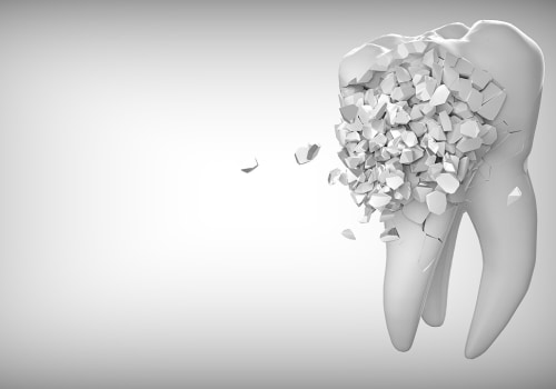 Understanding the Benefits of Dental X-Rays in Alexandria