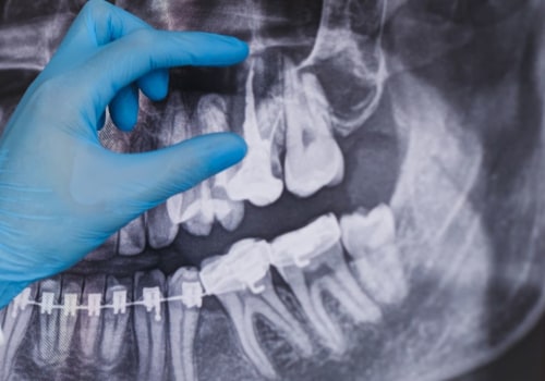 X-Ray Imaging In Dripping Springs, TX: How Dentists Use It to Diagnose And Treat Oral Health Issues
