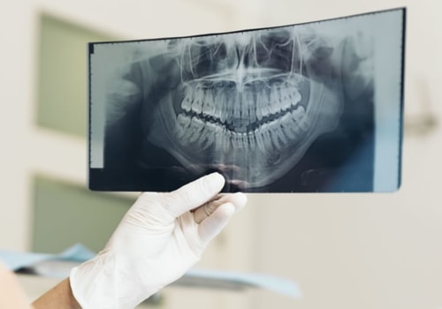 How To Determine If You Need A Dental X-ray Before Visiting A Dentist In New Jersey