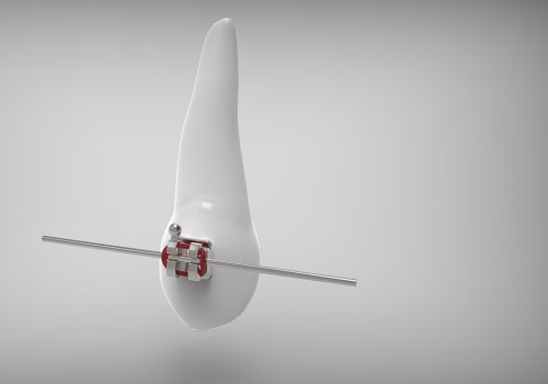 From Dental X-Rays to Braces: A Smarter Path to a Straighter Smile in Sacramento, CA