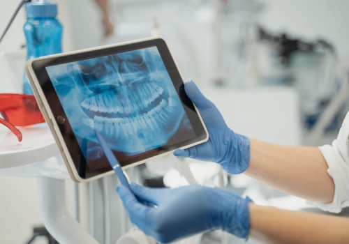 Why Dental X-rays Are Essential For Your Oral Health: Insights From A Spring Branch Dentist