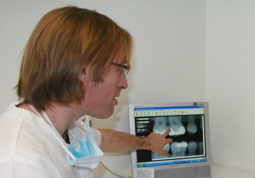 Why Dental X-Rays Are Essential For Orthodontic Diagnosis In Commerce City